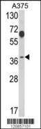 Proteasome 26S Subunit, Non-ATPase 7 antibody, MBS9207757, MyBioSource, Western Blot image 