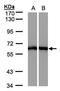 Malic Enzyme 1 antibody, orb73910, Biorbyt, Western Blot image 