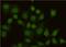 MutS Homolog 2 antibody, M00140-4, Boster Biological Technology, Immunocytochemistry image 
