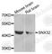 Sorting Nexin 32 antibody, A8006, ABclonal Technology, Western Blot image 