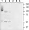 Transmembrane Channel Like 6 antibody, PA5-77755, Invitrogen Antibodies, Western Blot image 