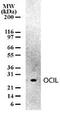 C-Type Lectin Domain Family 2 Member D antibody, MA1-41278, Invitrogen Antibodies, Western Blot image 