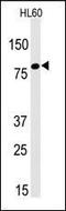 LEO1 Homolog, Paf1/RNA Polymerase II Complex Component antibody, PA5-11820, Invitrogen Antibodies, Western Blot image 