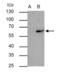 TERF2 Interacting Protein antibody, GTX101983, GeneTex, Immunoprecipitation image 