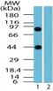 BCL2 Associated Transcription Factor 1 antibody, PA1-41680, Invitrogen Antibodies, Western Blot image 