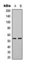 Myocyte Enhancer Factor 2A antibody, orb393104, Biorbyt, Western Blot image 