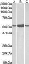 Aldehyde Dehydrogenase 1 Family Member A1 antibody, GTX90658, GeneTex, Western Blot image 