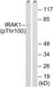 Interleukin 1 Receptor Associated Kinase 1 antibody, LS-C199133, Lifespan Biosciences, Western Blot image 