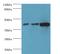 Protein Phosphatase Methylesterase 1 antibody, MBS7001306, MyBioSource, Western Blot image 