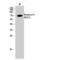 Tumor Protein P73 antibody, LS-C380597, Lifespan Biosciences, Western Blot image 