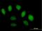 Scm Like With Four Mbt Domains 1 antibody, H00051460-B01P, Novus Biologicals, Immunocytochemistry image 