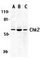 Checkpoint Kinase 2 antibody, orb74436, Biorbyt, Western Blot image 