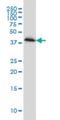 Pleckstrin antibody, H00005341-M01, Novus Biologicals, Western Blot image 