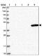 Unc-51 Like Kinase 3 antibody, PA5-59193, Invitrogen Antibodies, Western Blot image 