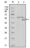 EPH Receptor A6 antibody, AM06292SU-N, Origene, Western Blot image 