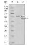 Ephrin type-A receptor 6 antibody, AM06292SU-N, Origene, Western Blot image 