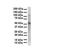 Preferentially Expressed Antigen In Melanoma antibody, GTX45142, GeneTex, Western Blot image 