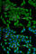Cellular Retinoic Acid Binding Protein 2 antibody, A6119, ABclonal Technology, Immunofluorescence image 