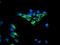 Dihydrolipoamide Dehydrogenase antibody, NBP2-01109, Novus Biologicals, Immunofluorescence image 