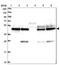 Sorting Nexin 15 antibody, NBP1-85866, Novus Biologicals, Western Blot image 