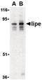 Lipase E, Hormone Sensitive Type antibody, PA5-20298, Invitrogen Antibodies, Western Blot image 