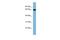 RIC8 Guanine Nucleotide Exchange Factor B antibody, PA5-70283, Invitrogen Antibodies, Western Blot image 