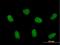 Zinc Finger CCHC-Type Containing 8 antibody, H00055596-B01P, Novus Biologicals, Immunofluorescence image 