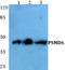 Proteasome 26S Subunit, Non-ATPase 6 antibody, A09338, Boster Biological Technology, Western Blot image 