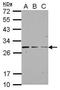 Nipsnap Homolog 2 antibody, GTX123963, GeneTex, Western Blot image 
