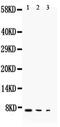 Transforming Growth Factor Alpha antibody, PA5-80116, Invitrogen Antibodies, Western Blot image 