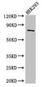 Tudor Domain Containing 3 antibody, CSB-PA863996LA01HU, Cusabio, Western Blot image 