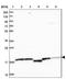 Sentan, Cilia Apical Structure Protein antibody, NBP1-92378, Novus Biologicals, Western Blot image 