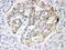 ISG15 Ubiquitin Like Modifier antibody, PA5-79522, Invitrogen Antibodies, Immunohistochemistry paraffin image 