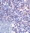 CD276 Molecule antibody, RF16095, ProSci Inc, Immunohistochemistry frozen image 