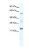 Casein Kinase 1 Gamma 1 antibody, MBS835832, MyBioSource, Western Blot image 