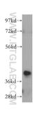 NAD(P) Dependent Steroid Dehydrogenase-Like antibody, 15111-1-AP, Proteintech Group, Western Blot image 