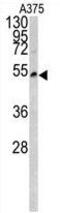 Lumican antibody, GTX81362, GeneTex, Western Blot image 