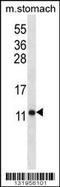 ATP Synthase Peripheral Stalk Subunit F6 antibody, TA324490, Origene, Western Blot image 