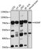 NMDA Receptor Synaptonuclear Signaling And Neuronal Migration Factor antibody, GTX64990, GeneTex, Western Blot image 