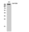 AT-Rich Interaction Domain 1B antibody, PA5-50918, Invitrogen Antibodies, Western Blot image 