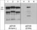 Eukaryotic Elongation Factor 2 Kinase antibody, EP4431, ECM Biosciences, Western Blot image 