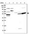 Tetratricopeptide Repeat Domain 23 antibody, NBP1-83718, Novus Biologicals, Western Blot image 