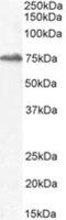 HIC ZBTB Transcriptional Repressor 1 antibody, NBP2-26159, Novus Biologicals, Western Blot image 