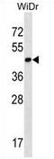 THAP Domain Containing 11 antibody, AP54237PU-N, Origene, Western Blot image 