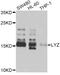 Lysozyme antibody, STJ24437, St John