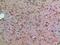 ABL Proto-Oncogene 2, Non-Receptor Tyrosine Kinase antibody, A02715, Boster Biological Technology, Immunohistochemistry frozen image 