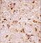 Fibroblast Growth Factor Receptor 3 antibody, LS-C164387, Lifespan Biosciences, Immunohistochemistry paraffin image 