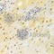 DNA Polymerase Beta antibody, A1681, ABclonal Technology, Immunohistochemistry paraffin image 