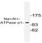 ATPase Na+/K+ Transporting Subunit Alpha 1 antibody, AP01364PU-N, Origene, Western Blot image 