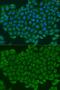 Troponin C2, Fast Skeletal Type antibody, GTX32938, GeneTex, Immunofluorescence image 